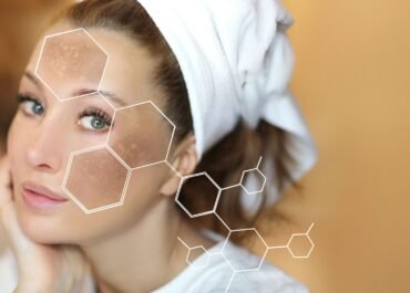 Macchie cutanee del viso: cause e rimedi per una pelle radiosa