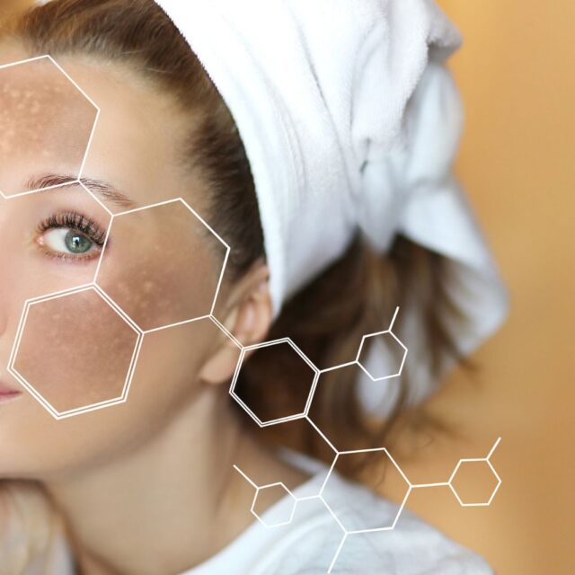 Macchie cutanee del viso: cause e rimedi per una pelle radiosa